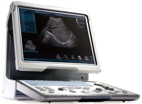 Mindray DP50 Ultrasound