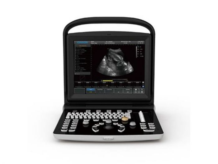 Chison ECO3 EXPERT B/W Portable Ultrasound