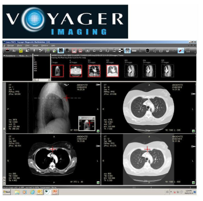 Voyager PACS