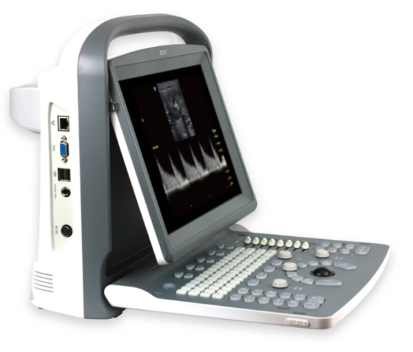 Chison Econ1-V B/W Ultrasound Scanner