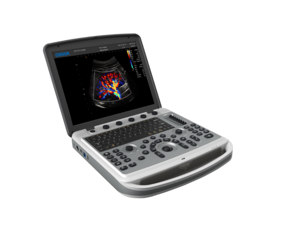 Chison Sonobook 6