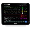 BLT S12 Vet Monitor