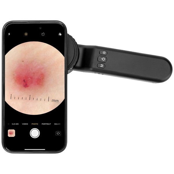 Iboolo_DE-1400_Pro_05 Iboolo DE-1400 Pro Dertamoscope