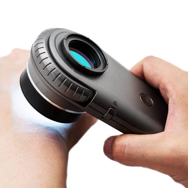 Illuco IDS 1100 Dermatoscope