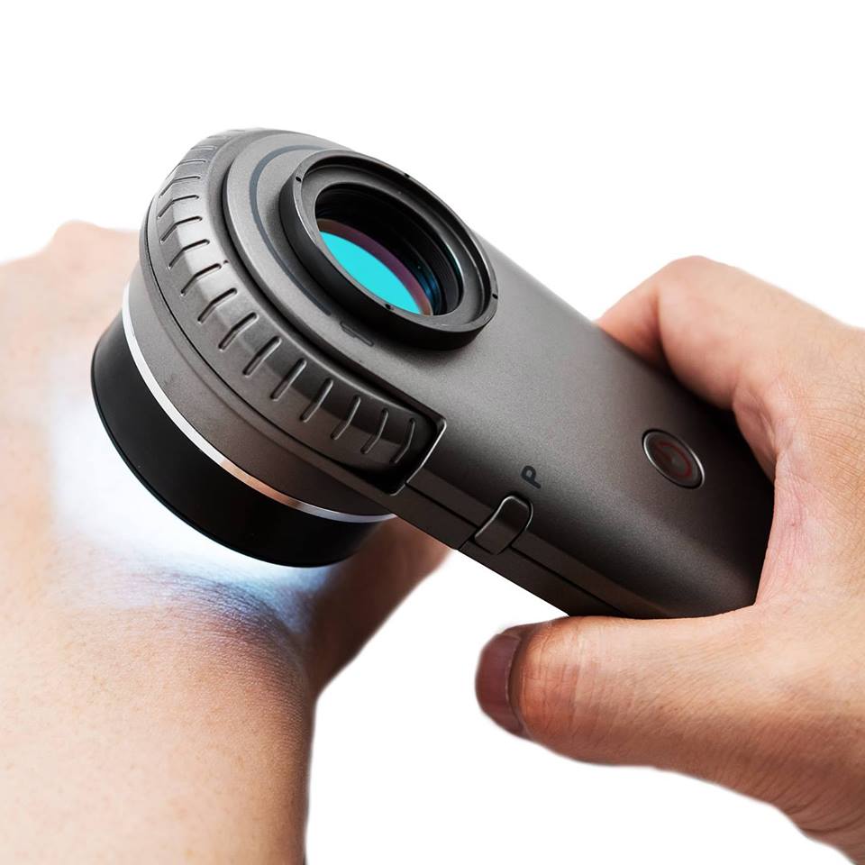 Illuco IDS 1100 Dermatoscope